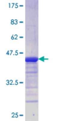 SDS-Page: Recombinant Human SNAP29 Protein [H00009342-Q01] - 12.5% SDS-PAGE Stained with Coomassie Blue.