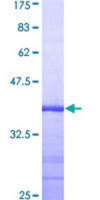 SDS-Page: Recombinant Human TAO2 Protein [H00009344-Q01] - 12.5% SDS-PAGE Stained with Coomassie Blue.