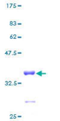 12.5% SDS-PAGE Stained with Coomassie Blue.