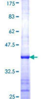 SDS-Page: Recombinant Human 60S ribosomal protein L23 Protein [H00009349-Q01] - 12.5% SDS-PAGE Stained with Coomassie Blue.