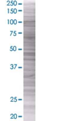 CER1 transfected lysate.