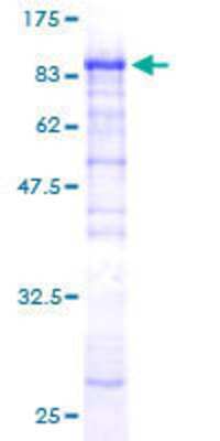 12.5% SDS-PAGE Stained with Coomassie Blue.