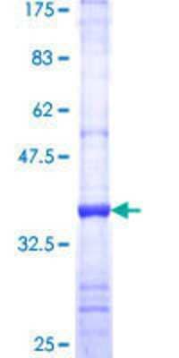 12.5% SDS-PAGE Stained with Coomassie Blue.