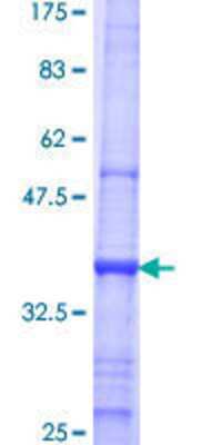 12.5% SDS-PAGE Stained with Coomassie Blue.