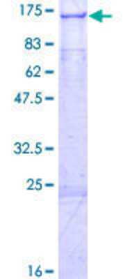 12.5% SDS-PAGE Stained with Coomassie Blue.