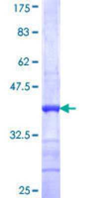 12.5% SDS-PAGE Stained with Coomassie Blue.