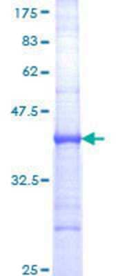 12.5% SDS-PAGE Stained with Coomassie Blue.