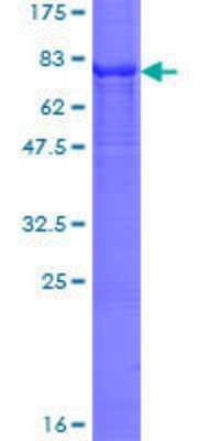 12.5% SDS-PAGE Stained with Coomassie Blue.