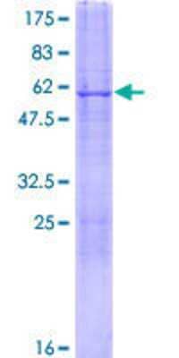 SDS-PAGE Recombinant Human CDYL GST (N-Term) Protein