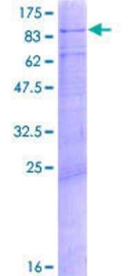 Recombinant Human MED17 Protein [H00009440-P02] - 12.5% SDS-PAGE Stained with Coomassie Blue.