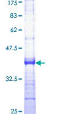 12.5% SDS-PAGE Stained with Coomassie Blue.