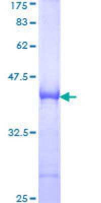 SDS-Page: Recombinant Human SH3BP5 Protein [H00009467-Q01] - 12.5% SDS-PAGE Stained with Coomassie Blue.