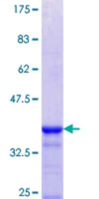 12.5% SDS-PAGE Stained with Coomassie Blue.
