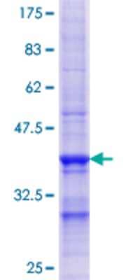 SDS-Page: Recombinant Human ENTPD4 Protein [H00009583-Q01] - 12.5% SDS-PAGE Stained with Coomassie Blue.