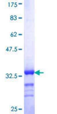 SDS-Page: Recombinant Human HCC1 Protein [H00009584-Q01] - 12.5% SDS-PAGE Stained with Coomassie Blue.