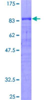 12.5% SDS-PAGE Stained with Coomassie Blue.