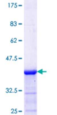SDS-Page: Recombinant Human NIR2 Protein [H00009600-Q01] - 12.5% SDS-PAGE Stained with Coomassie Blue.