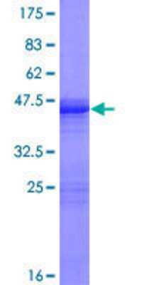 SDS-PAGE Recombinant Human GCAP3 GST (N-Term) Protein