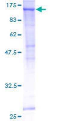 Recombinant Human SEC24C Protein [H00009632-P01] - 12.5% SDS-PAGE Stained with Coomassie Blue.