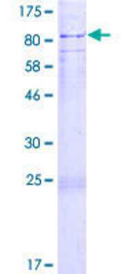 SDS-Page: Recombinant Human SOCS-5 Protein [H00009655-P02] - 12.5% SDS-PAGE Stained with Coomassie Blue.