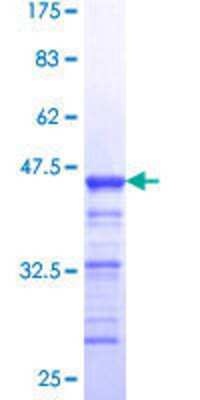 12.5% SDS-PAGE Stained with Coomassie Blue.