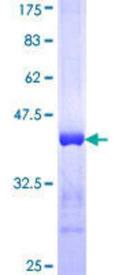 SDS-Page: Recombinant Human Eukaryotic translation initiation factor 5B Protein [H00009669-Q01] - 12.5% SDS-PAGE Stained with Coomassie Blue.