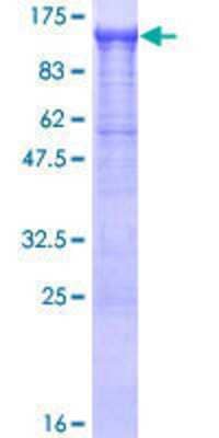 12.5% SDS-PAGE Stained with Coomassie Blue.