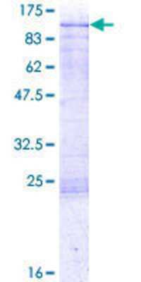 12.5% SDS-PAGE Stained with Coomassie Blue.