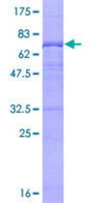 12.5% SDS-PAGE Stained with Coomassie Blue.