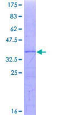 SDS-Page: Recombinant Human UBE3C Protein [H00009690-Q01] - 12.5% SDS-PAGE Stained with Coomassie Blue.