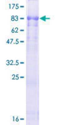 12.5% SDS-PAGE Stained with Coomassie Blue.