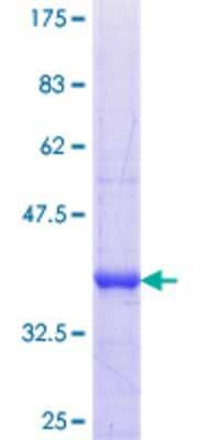 SDS-Page: Recombinant Human NOS1AP Protein [H00009722-Q01] - 12.5% SDS-PAGE Stained with Coomassie Blue.