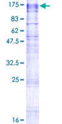 SDS-Page: Recombinant Human TMEM63A Protein [H00009725-P01] - 12.5% SDS-PAGE Stained with Coomassie Blue.