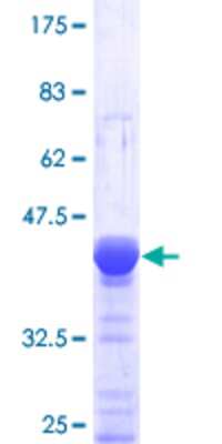 SDS-Page: Recombinant Human DOCK4 Protein [H00009732-Q01] - 12.5% SDS-PAGE Stained with Coomassie Blue.