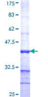 12.5% SDS-PAGE Stained with Coomassie Blue.