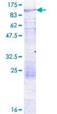 12.5% SDS-PAGE Stained with Coomassie Blue.