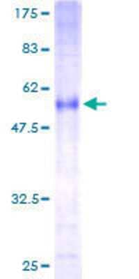 12.5% SDS-PAGE Stained with Coomassie Blue.