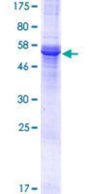 Other Recombinant Human PHYHIP GST (N-Term) Protein