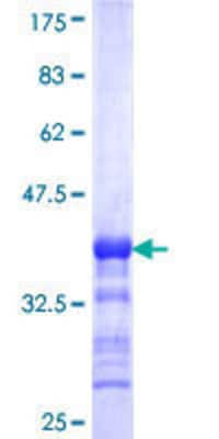 Other Recombinant Human IP6K1 GST (N-Term) Protein