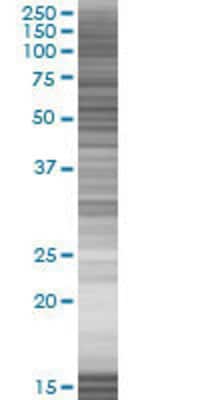 IHPK1 transfected lysate.