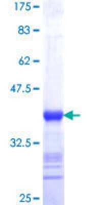 SDS-Page: Recombinant Human SPATA2 Protein [H00009825-Q01] - 12.5% SDS-PAGE Stained with Coomassie Blue.