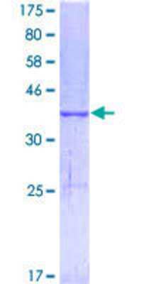 SDS-PAGE Recombinant Human MELK GST (N-Term) Protein