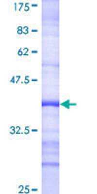 12.5% SDS-PAGE Stained with Coomassie Blue.