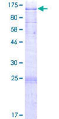 SDS-Page: Recombinant Human TMEM24 Protein [H00009854-P01] - 12.5% SDS-PAGE Stained with Coomassie Blue.