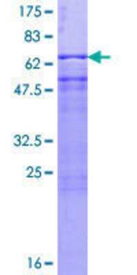 12.5% SDS-PAGE Stained with Coomassie Blue.