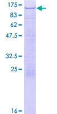 12.5% SDS-PAGE Stained with Coomassie Blue.