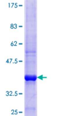 SDS-Page: Recombinant Human OSBPL2 Protein [H00009885-Q01] - 12.5% SDS-PAGE Stained with Coomassie Blue.