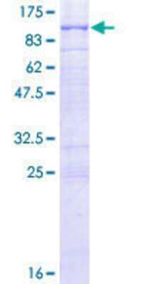 SDS-Page: Recombinant Human RHOBTB1 Protein [H00009886-P01] - 12.5% SDS-PAGE Stained with Coomassie Blue.