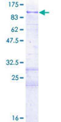 Recombinant Human ARK5/NUAK1 Protein [H00009891-P01] - 12.5% SDS-PAGE Stained with Coomassie Blue.