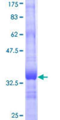 12.5% SDS-PAGE Stained with Coomassie Blue.